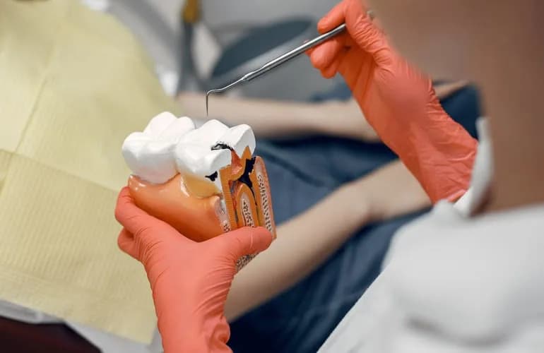 what is root canal treatment