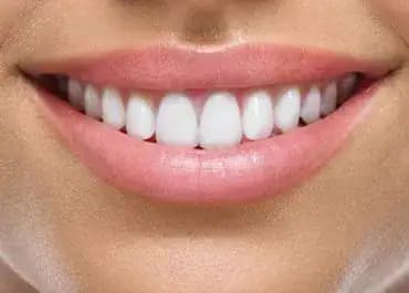 Ceramic Dental Crowns - Neola Dental
