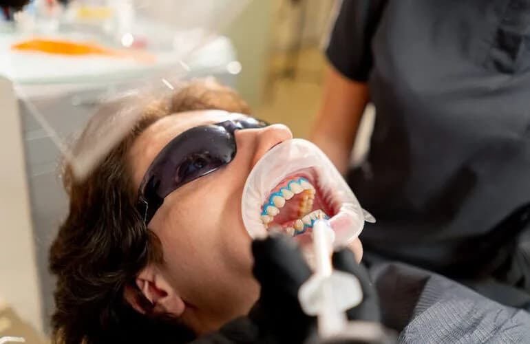 dental philips zoom whitening treatment