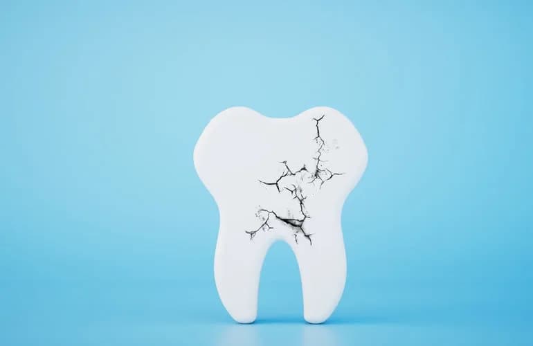 what causes cracked teeth